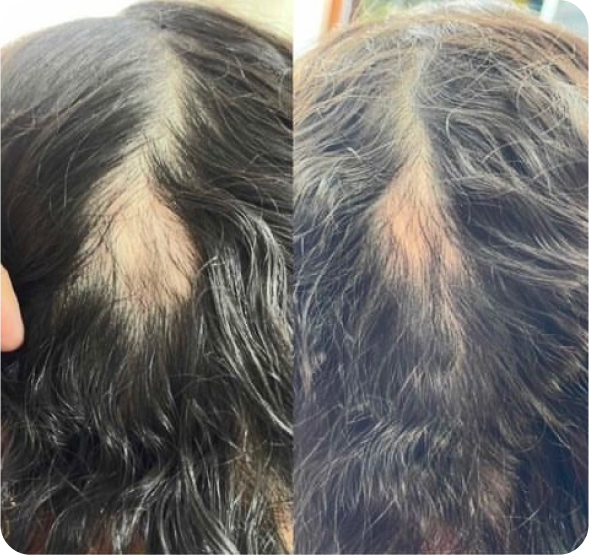 Human Doctors - Human Hair'
